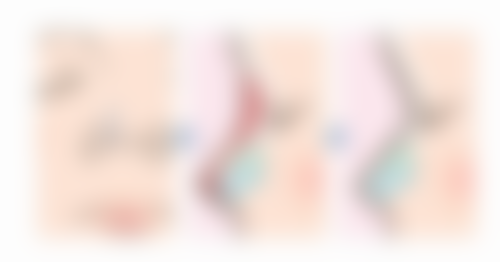 四川成都美容整形医院私密科的预约方式