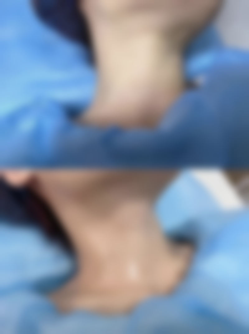 方法二：调整体位与活动对消肿有帮助吗？