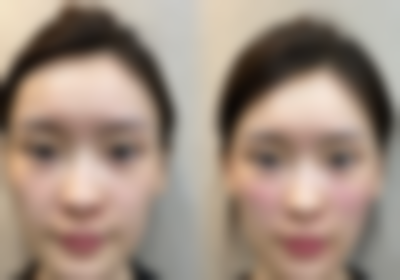 如何获取四川成都美容整形医院私密科邓娟娟联系电话