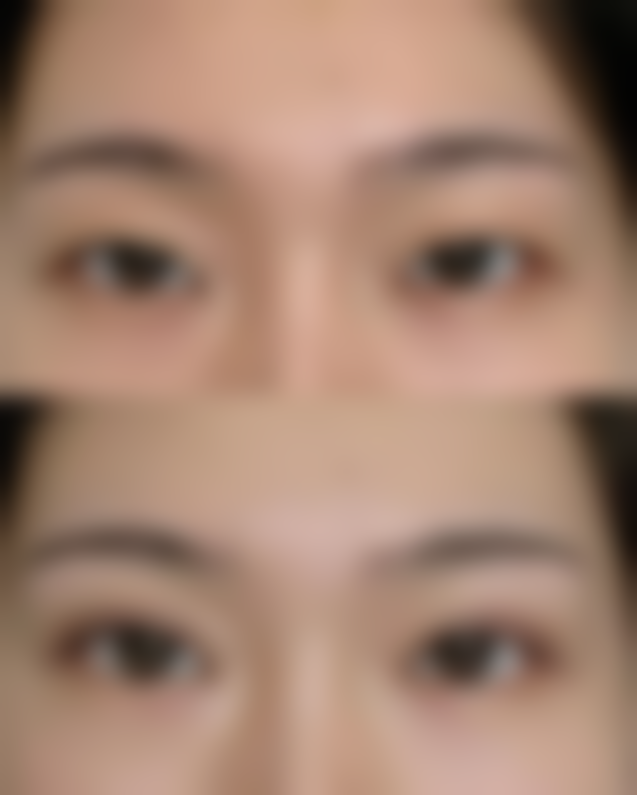 邓娟娟坐诊四川成都美容整形医院私密科医生优势