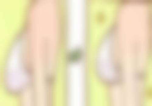 为什么要谨慎考虑割完双眼皮后再做埋线？