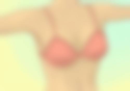 医生在决定双眼皮六天还是七天拆线时会考虑哪些因素呢？