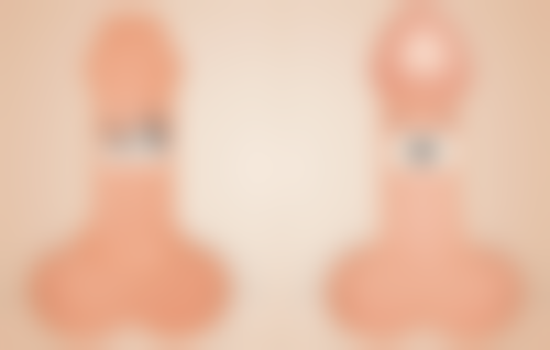 选择不开刀去眼袋医院和医生要注意什么？