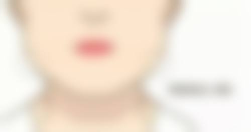 影响四川成都美容整形医院私密科收费的因素