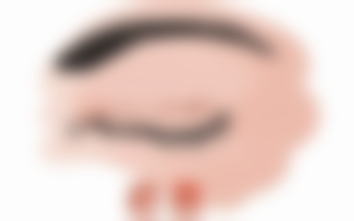 四川成都美容整形医院阴道紧缩手术（中度）采用了什么技术？