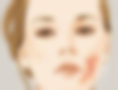 美容瘦脸针会引起过敏反应吗？