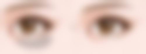 术后在饮食方面有什么需要注意的吗？