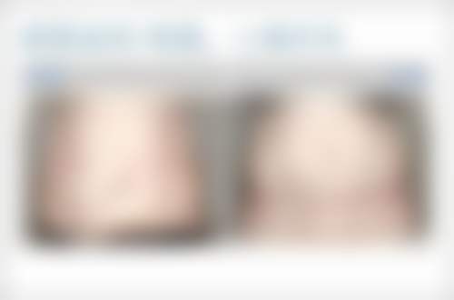 基于皮肤修复情况，间隔时间该怎么确定呢？