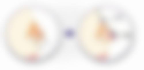 割双眼皮手术前需要做哪些准备呢？