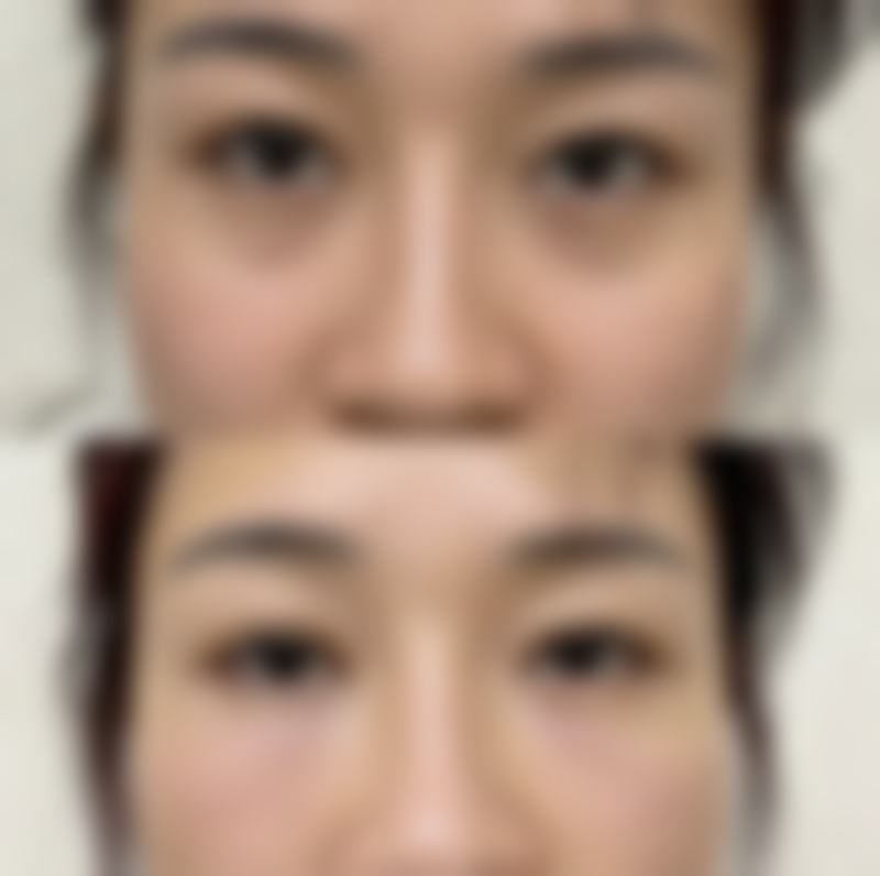 如何选择专精医生和正规医院？