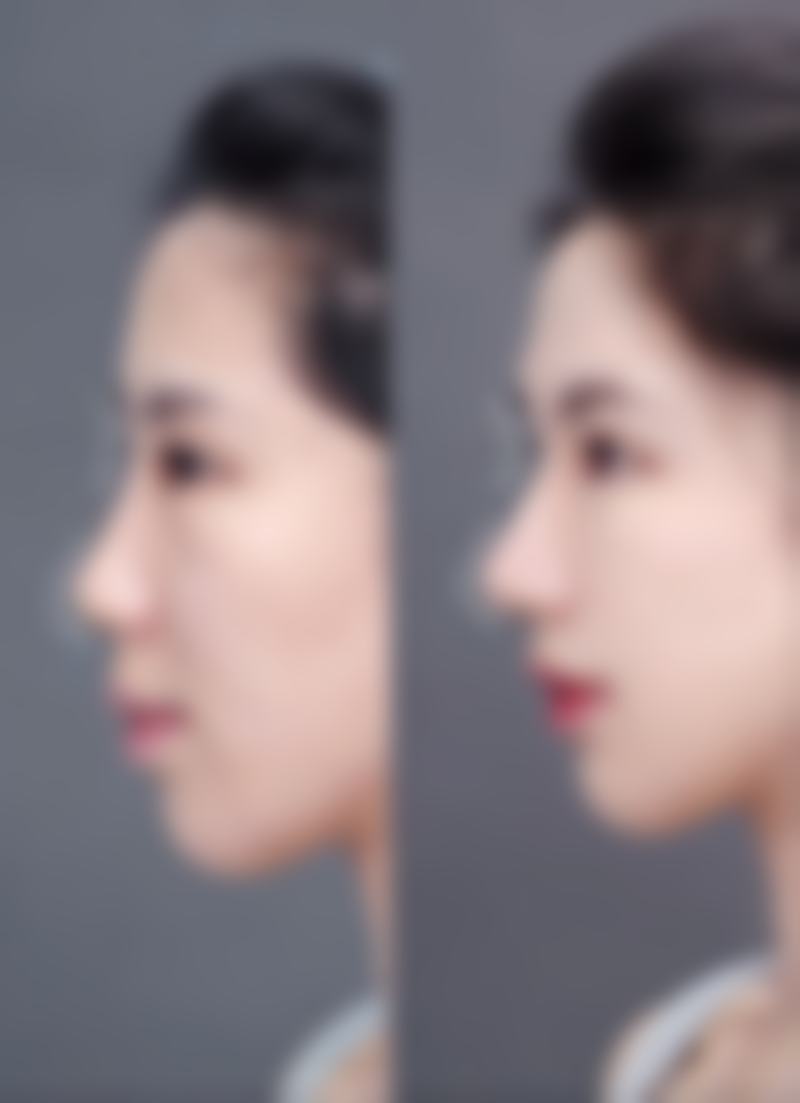 四川成都美容整形医院在小阴唇整形手术（外缝单侧）方面有哪些优势？