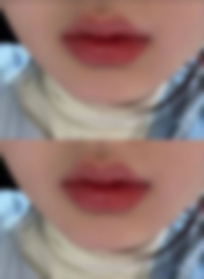 美容瘦脸针对肌肉功能会有什么影响呢？