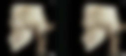 哪些人适合四川成都美容整形医院阴道紧缩手术(轻度)?