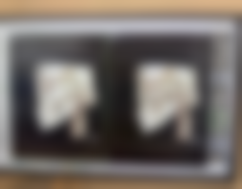 月经期不适合手术，是哪些原因在“捣乱”呢？