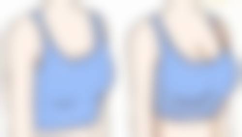 去眼袋手术是如何改善眼部问题的呢？