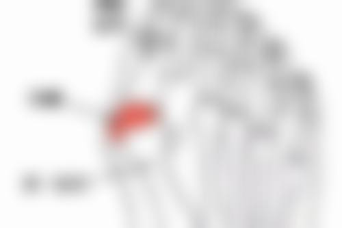 治疗痤疮疤痕期间如何护理?