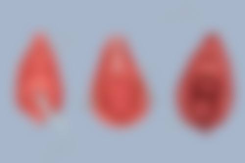 除了上述提到的食物，还有其他有助于双眼皮增生修复的食物吗？