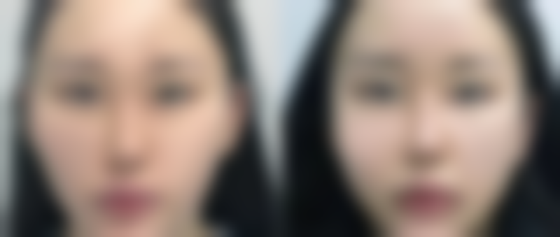 衡阳魅力红唇医疗美容门诊部口碑评价怎么样？