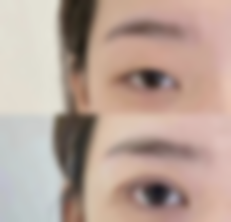 四川成都美容整形医院阴道紧缩手术（重度）适合哪些人群？