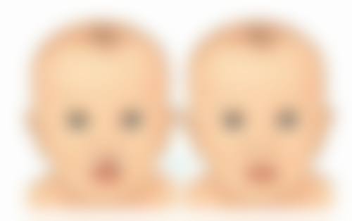 美乐提® 小脸针(提升针)(提拉紧致型)的优势和适用对象是谁?