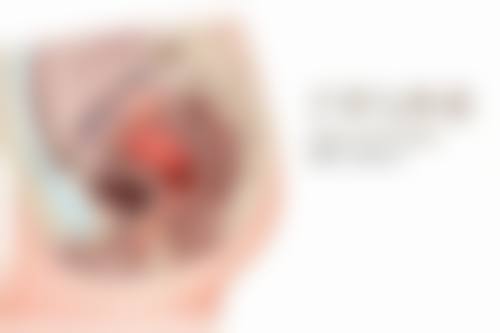 男士发际线和疤痕种植的长期成效如何?