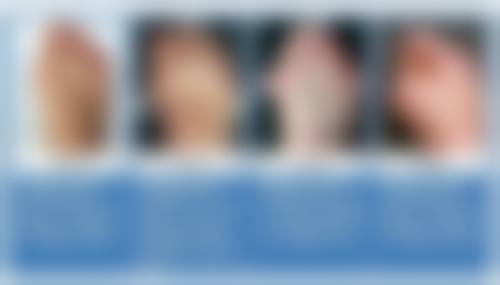 手术切除疤痕适合什么样的情况呢？