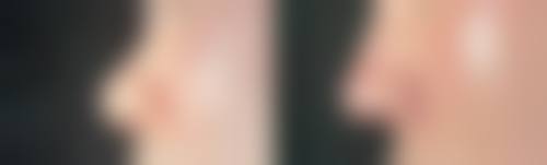 成都高新仁美人和整形医院怎么预约