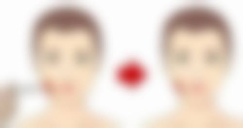 术后出现哪些反应是正常的,哪些需要警惕呢?