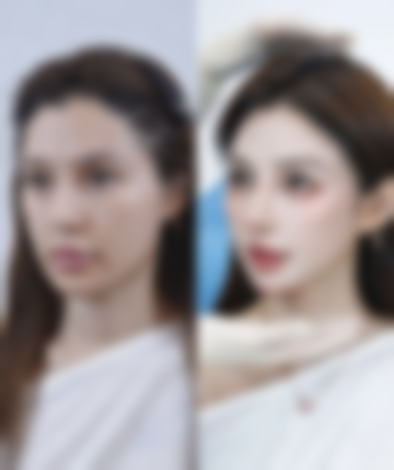 生活习惯调整:睡姿、运动和用眼习惯该怎么改?