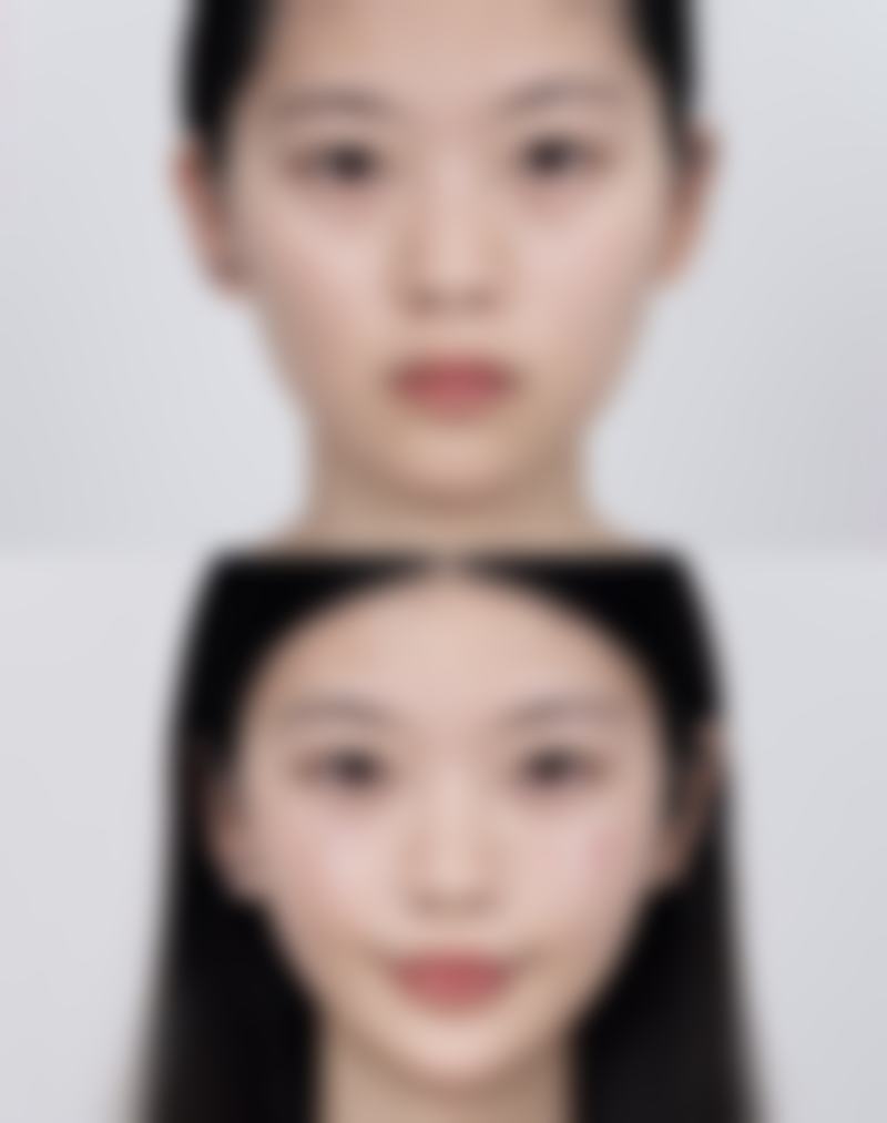 积液吸收过程中有哪些美学及健康提示？