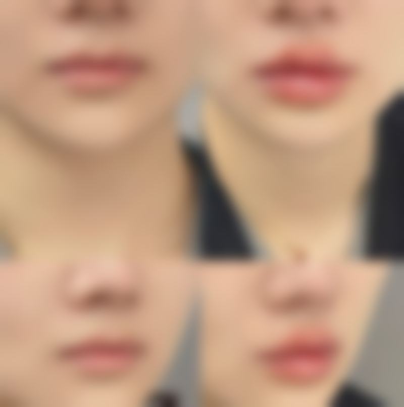 成都高新仁美人和整形医院口碑评价怎么样?