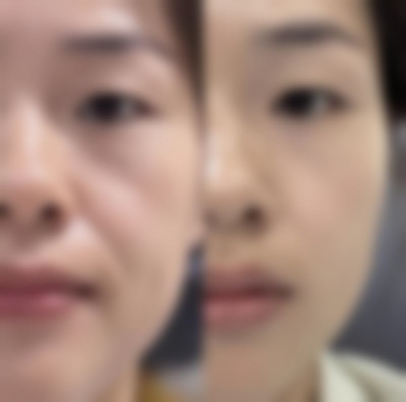 辽宁阜新柠勃整形美容医院口碑评价怎么样？