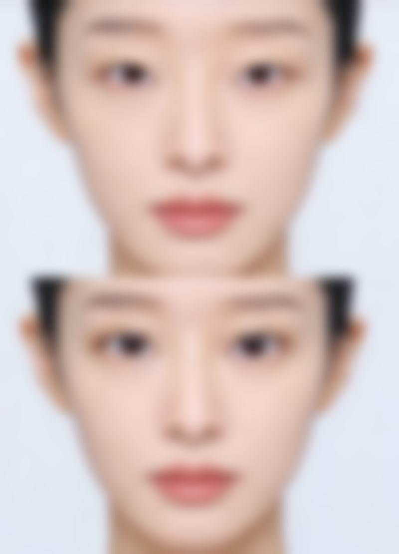 四川成都美容整形医院私密科邓娟娟医生擅长项目