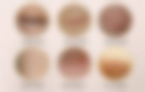 导致韩式三点双眼皮失败的原因是什么呢?