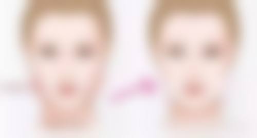 七问：手术切除 + 放疗适合什么样的疤痕疙瘩，有啥作用和注意事项呢？