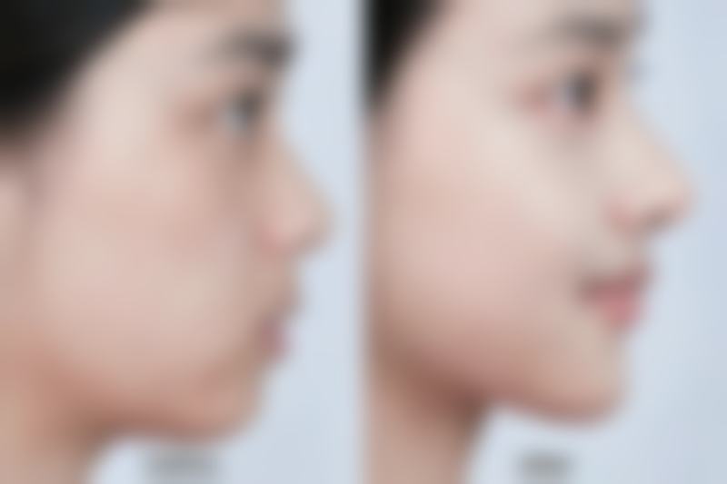 开原贝优缇整形医院口碑评价怎么样?