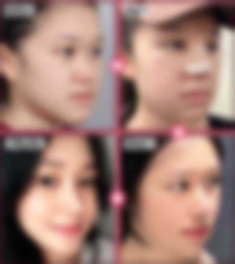 问题三：冷热敷护理是如何发挥作用的，成效怎么样？