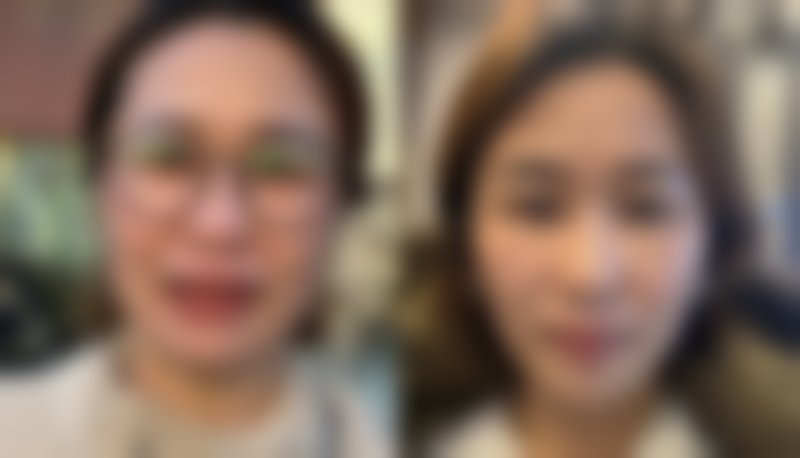 洛阳雅美嘉医疗美容门诊部石音医生患者评价