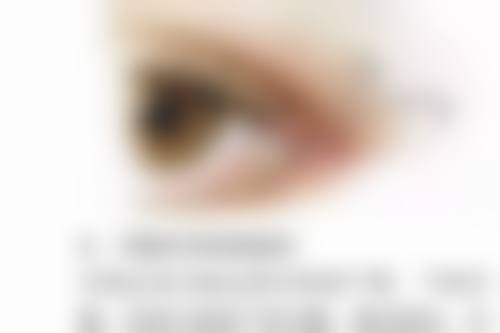 一般的毛发种植到底贵不贵呢？