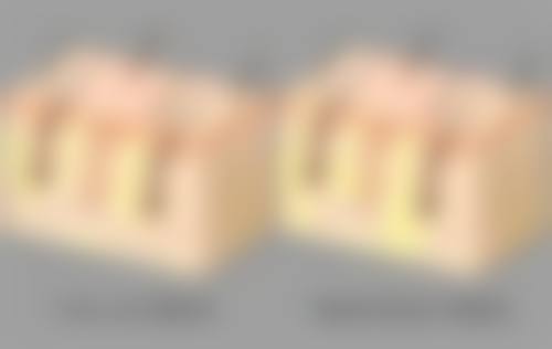 哪些人适合做纳米无痕双眼皮？