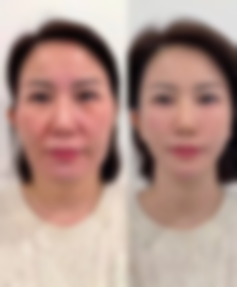 国内长城铝业公司总医院整形美容科正规吗?