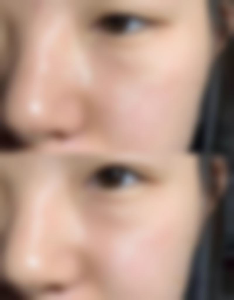 四川成都美容整形医院私密科李挺收费与成效成正比吗？