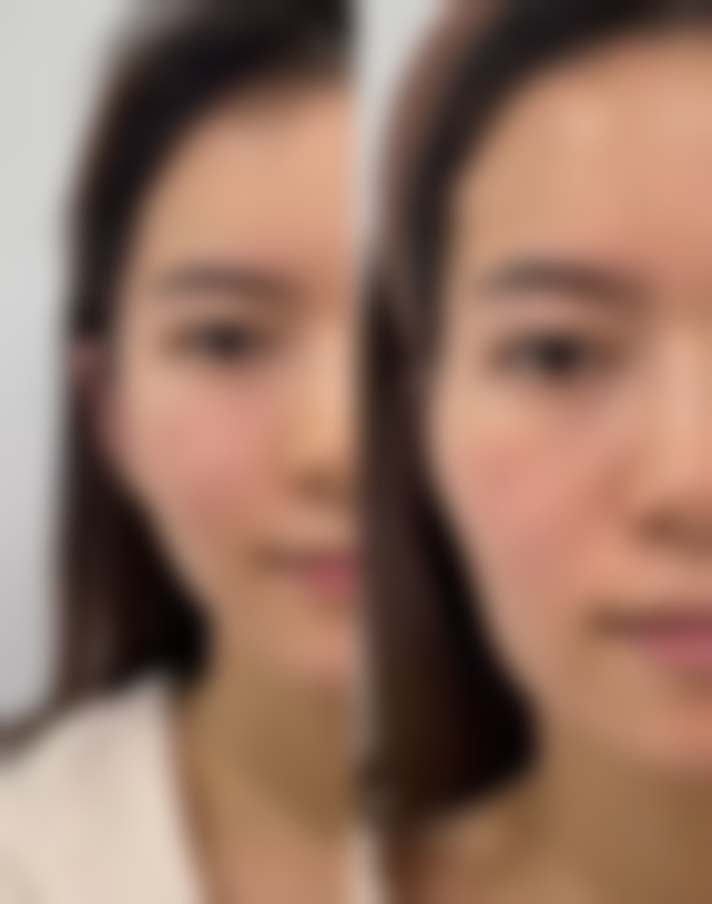 手术疤痕恢复需要多久？了解影响恢复时间的关键因素与护理技巧，术后饮食会影响恢复吗？ 