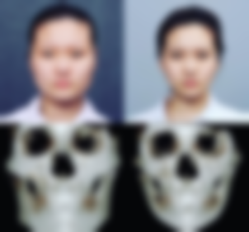 广州弦美皮肤整形医院怎么预约: