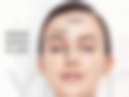 广州中山大学孙逸仙纪念医院孟强医生收费价格