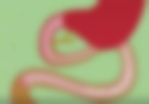 做双眼皮有哪些风险？专家详解让你避免手术后悔的关键因素！如何选医生和护理？ 