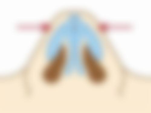 广州皇佳贝丽医疗美容门诊部怎么预约