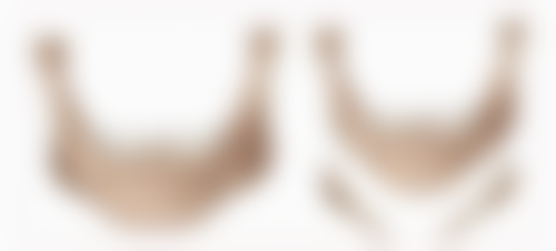 小孩双眼皮多久定型？揭秘影响因素与最佳护理方法！遗传和环境因素谁影响更大？ 