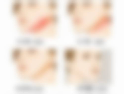 手术治疗适合什么样的眉目疤痕?