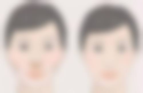 东莞安美医疗美容门诊部黄峻医生烧伤整形技术怎么样?